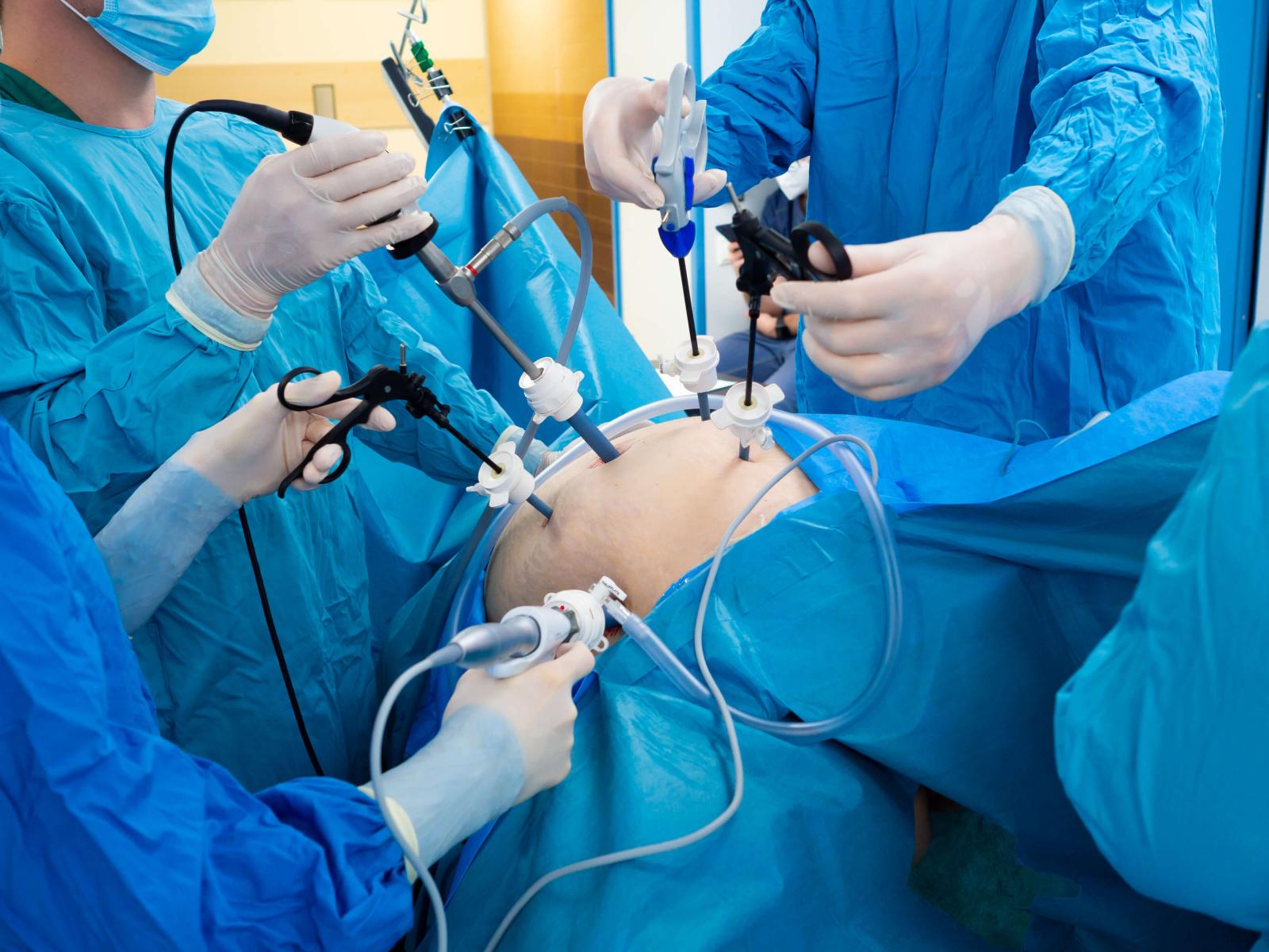 Cirurgia Bariátrica pelo Plano de Saúde: Entenda Seus Direitos
