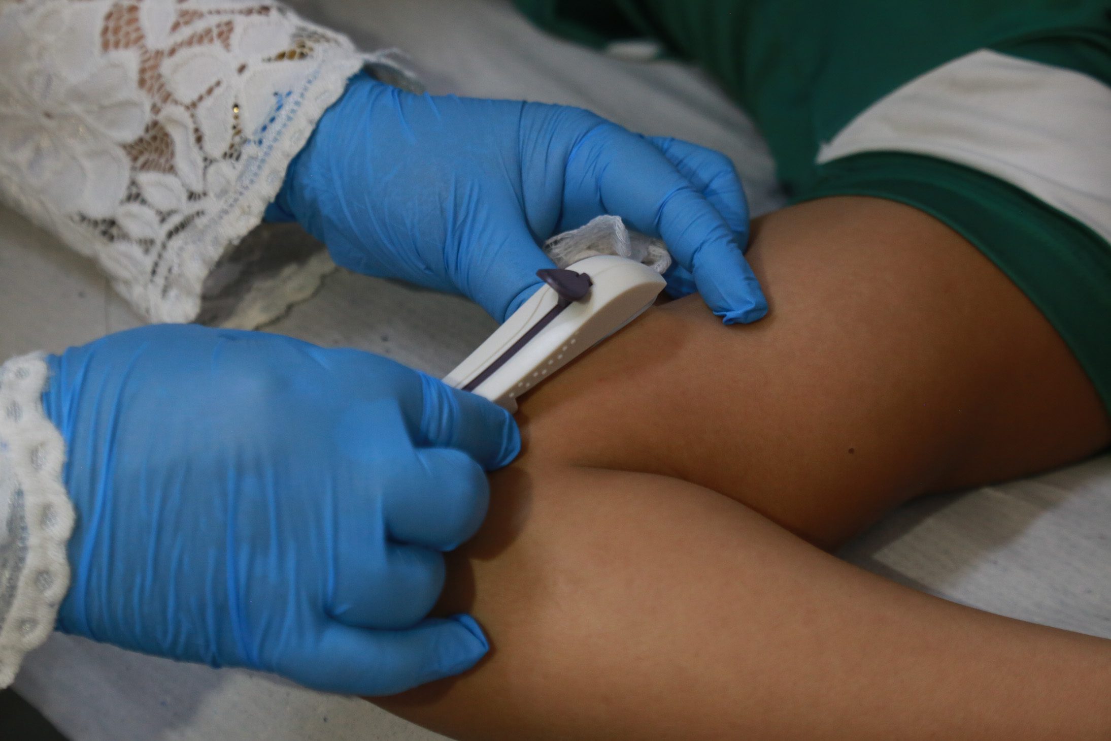 A partir de julho de 2026, planos de saúde deverão cobrir o Implanon para adolescentes de 15 a 17 anos. Entenda o que muda e quais os impactos da nova regra da ANS.